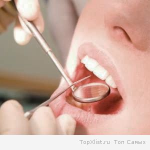 снятие зубного камня ультразвуком